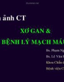 Hình ảnh CT Xơ gan và Các bệnh lý mạch máu gan