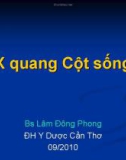 Bài giảng: X quang cột sống