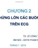 Bài giảng ECG - Chương 2: Hội chứng lớn các buồng tim trên ECG