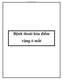 Bệnh thoái hóa điểm vàng ở mắt