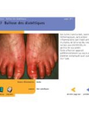 Atlas de dermatologie - part 8