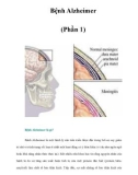 Bệnh Alzheimer (Phần 1)