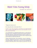 Bệnh Viêm Xương Khớp