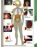 Atlas de poche d immunologie - part 7