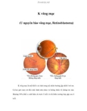 K võng mạc (U nguyên bào võng mạc, Retinoblastoma)