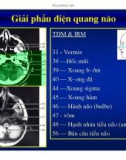 Bài giảng : Giải phẫu thần kinh đối chiếu chẩn đoán Hình ảnh part 5