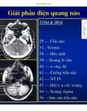 Giải phẫu thần kinh đối chiếu chẩn đoán Hình ảnh part 8