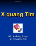 X quang tim - BS. lâm Đông Phong - ĐH Y dược Cần Thơ