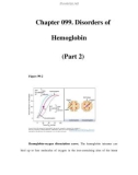 Chapter 099. Disorders of Hemoglobin (Part 2)