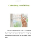 Chữa chứng ra mồ hôi tay