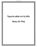 Nguyên nhân trẻ bị biến dạng cột sống