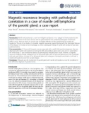 Báo cáo y học: Magnetic resonance imaging with pathological correlation in a case of mantle cell lymphoma of the parotid gland: a case report