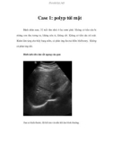 Case 1: polyp túi mật