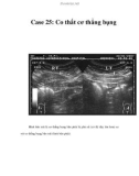 Case 25: Co thắt cơ thẳng bụng