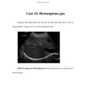 Case 14: Hemangioma gan