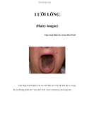 LƯỠI LÔNG (Hairy tongue)