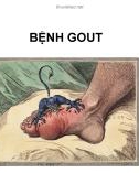 Bài giảng Bệnh gout