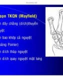 Chẩn đoán TRẬT KHỚP QUANH NGUYỆT part 2