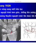 Chẩn đoán TRẬT KHỚP QUANH NGUYỆT part 3