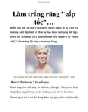 Làm trắng răng cấp tốc…