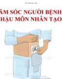 Bài giảng Chăm sóc người bệnh có hậu môn nhân tạo