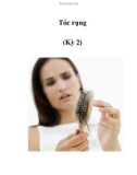 Tóc rụng (Kỳ 2)