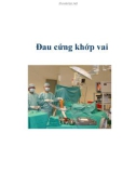 Đau cứng khớp vai