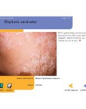 Atlas de dermatologie - part 6