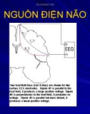 Bài giảng điện não tâm đồ EEG_Phần 2