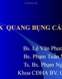 Bài giảng: X quang bụng cấp