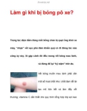 Làm gì khi bị bỏng pô xe?