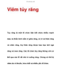 Tìm hiểu về Viêm tủy răng