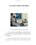 Cao răng và bệnh răng miệng