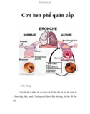 Cơn hen phế quản cấp