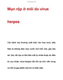 Mụn rộp ở môi do virus herpes