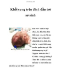 Khối sưng trên đỉnh đầu trẻ sơ sinh