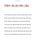 Biểu hiện Viêm da do liên cầu