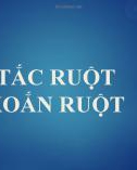 TẮC RUỘT XOẮN RUỘT