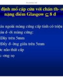 HÌNH ẢNH CẮT LỚP VI TÍNH CHẤN THƯƠNG SỌ NÃO part 2