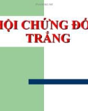 Hội chứng đốm trắng