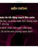 DẪN LƯU MÀNG PHỔI (PHẦN 4)