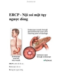 ERCP - Nội soi mật tụy ngược dòng