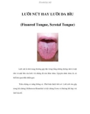 LƯỠI NỨT HAY LƯỠI DA BÌU (Fissured Tongue, Scrotal Tongue) Lưỡi nứt là tình trạng