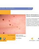 Atlas de dermatologie - part 10