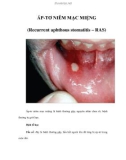 ÁP-TƠ NIÊM MẠC MIỆNG (Recurrent aphthous stomatitis – RAS)