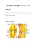 U Nang Bao Hoạt Dịch (synovial Cyst)