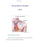 Máy tạo nhịp tim - Pacemaker (Kỳ 3)