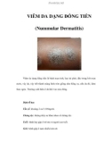 VIÊM DA DẠNG ĐỒNG TIỀN (Nummular Dermatitis)