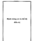 Bệnh trứng cá và chế độ điều trị