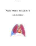 Pleural effusion - laboratories in common cause